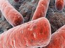 ¿Qué es la tuberculosis, cómo se transmite y previene?